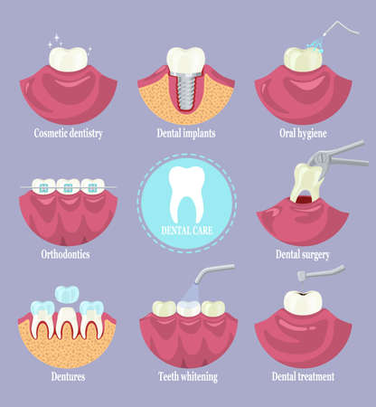 Dental care set, flat vector isolated illustration. Types of dentist clinic services. Dentistry.のイラスト素材