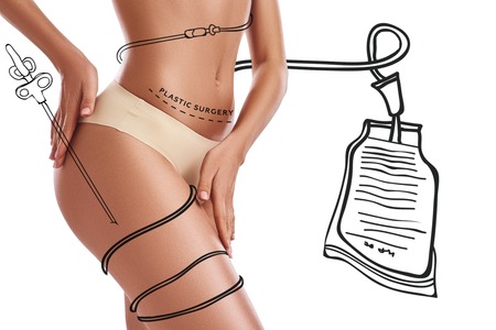 Sculpt your body. Young woman in underwear is showing her beautiful thigh while standing against white background with hand drawn illustration on it. Liposuction conceptの写真素材