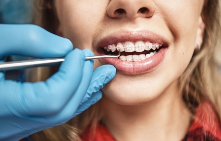 Keep calm and smile. Teen at the dental office. Dentist examining girls teeth in clinic.の素材 [FY310120919482]