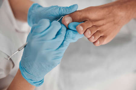 Podiatrist in blue gloves cleans toenail of man using special probe in beauty salon