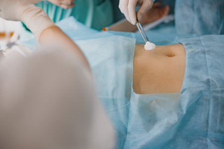 Close up of nurse and doctor hand preparing patient skin for surgery using antiseptic solutionの写真素材