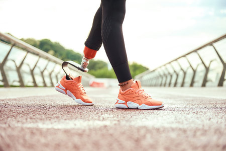 Cropped view of disabled woman with leg prosthesis standing on the bridge in the morningの写真素材