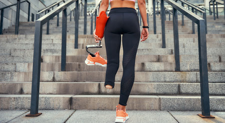 Just do it. Back view of disabled women in sports clothing holding her leg prosthesis while standing on stairs outdoorsの写真素材