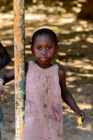 BUBAQUE, GUINEA BISSAU - MAY 5, 2017: Unidentified local little girl in pink dress with dirty face stands near the pole in a village of the Bubaque island. People in G.-Bissau still suffer of povertyのeditorial素材