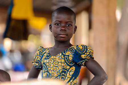 BOHICON, BENIN - JAN 12, 2017: Unidentified Beninese little girl with a scar on her face stands at the local market. Benin children suffer of poverty due to the bad economy.のeditorial素材