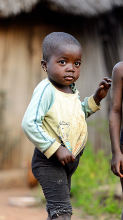 MASSIF KABYE, TOGO - JAN 13, 2017: Unidentified Togolese  little girl in dirty shirt looks ahead in the village. Togo children suffer of poverty due to the bad economy.のeditorial素材