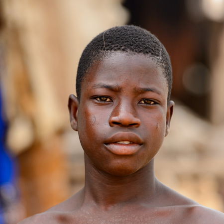 LOME, TOGO - Jan 9, 2017: Unidentified Togolese boy with scars on his face at the Lome fetish market. Togo people suffer of poverty due to the bad economyのeditorial素材