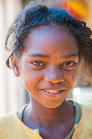 MADAGASCAR - JUNE 30, 2011: Unidentified Madagascar girl with curly hair smiles for the camera in Madagascar, June 30, 2011. Children of Madagascar suffer of poverty due to the unstable situation.のeditorial素材