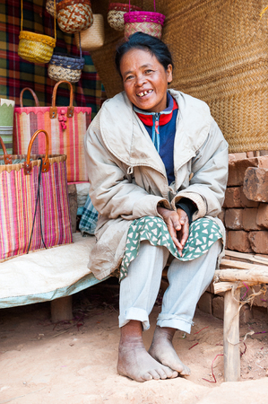 ANTANANARIVO, MADAGASCAR - JUNE 29, 2011: Unidentified Madagascar woman sits in the street and smiles. People in Madagascar suffer of poverty due to the slow development of the countryのeditorial素材