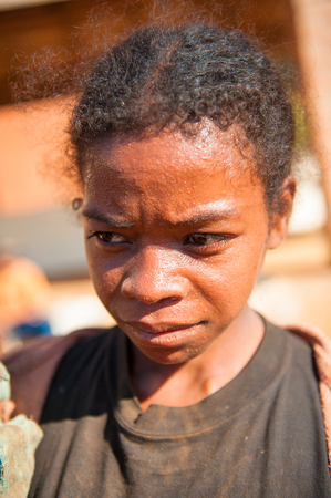 MADAGASCAR - JULY 1, 2011: Portrait of an unidentified little boy in Madagascar, July 1, 2011. Children of Madagascar suffer of poverty due to the unstable situation.のeditorial素材