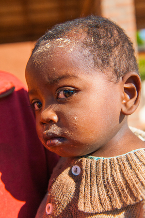 MADAGASCAR - JULY 1, 2011: Portrait of an unidentified dirty little girl in Madagascar, July 1, 2011. Children of Madagascar suffer of poverty due to the unstable situation.のeditorial素材