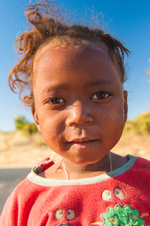 MADAGASCAR - JULY 3, 2011: Portrait of an unidentified girl with wierd hair cut in Madagascar, July 3, 2011. Children of Madagascar suffer of poverty due to the unstable situation.のeditorial素材