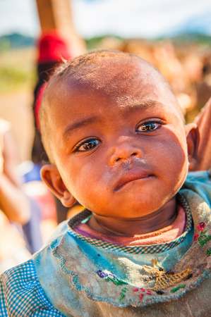 MADAGASCAR - JULY 1, 2011: Portrait of an unidentified dirty little girl in Madagascar, July 1, 2011. Children of Madagascar suffer of poverty due to the unstable situation.のeditorial素材