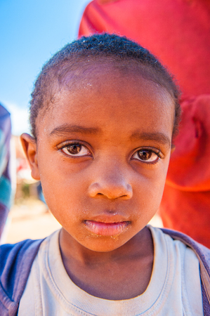 MADAGASCAR - JULY 1, 2011: Portrait of an unidentified little girl in Madagascar, July 1, 2011. Children of Madagascar suffer of poverty due to the unstable situation.のeditorial素材