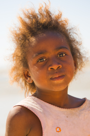 MADAGASCAR - JULY 5, 2011: Portrait of an unidentified girl in Madagascar, July 5, 2011. Children of Madagascar suffer of poverty due to the unstable situation.のeditorial素材
