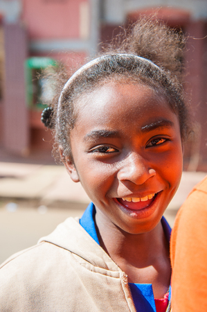 MADAGASCAR - JUNE 30, 2011: Unidentified Madagascar girl with curly hair in Madagascar, June 30, 2011. Children of Madagascar suffer of poverty due to the unstable situation.のeditorial素材