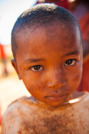 MADAGASCAR - JULY 1, 2011: Portrait of an unidentified angry little girl in Madagascar, July 1, 2011. Children of Madagascar suffer of poverty due to the unstable situation.のeditorial素材
