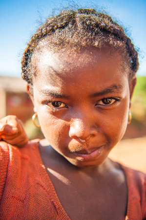 MADAGASCAR - JULY 1, 2011: Portrait of an unidentified angry little girl in Madagascar, July 1, 2011. Children of Madagascar suffer of poverty due to the unstable situation.のeditorial素材