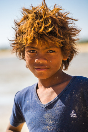 MADAGASCAR - JULY 5, 2011: Portrait of an unidentified boy with blond hair in Madagascar, July 5, 2011. Children of Madagascar suffer of poverty due to the unstable situation.のeditorial素材
