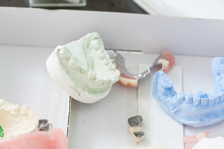 Dental sample instruments in clinic use for orthodontics issues. Dental care and treatment conceptの写真素材