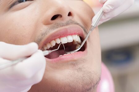 A man getting dental treatment in clinic with dentist. Dental care and healthy maintenance conceptの写真素材