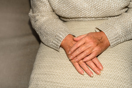 Hands of senior woman with varicose veinsの写真素材