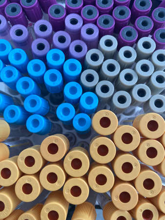 Multiples colored blood collection tubes close-up top viewの写真素材