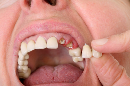 Patient hold broken artificial tooth beside open  mouth