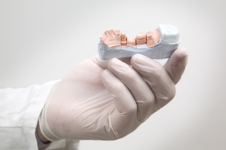 Dentist holding  plaster model of tooth in hand with glovesの写真素材