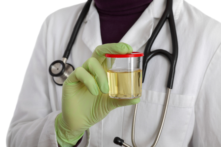 Doctor holding container with urine sample in hand, isolated on white backgroundの写真素材