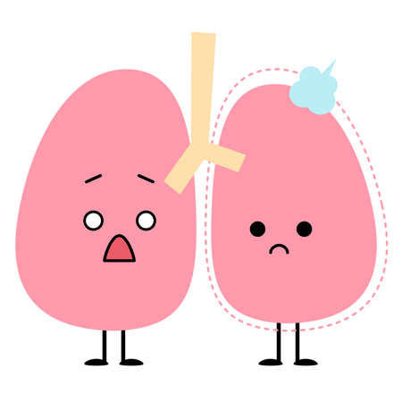 Lungs that have shrunk due to pneumothoraxのイラスト素材