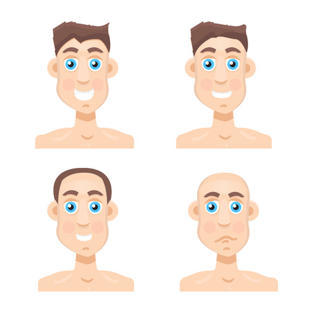 Stages Of Hair Loss new before and afterのイラスト素材