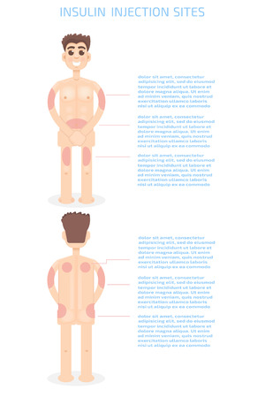 Injection sites infographicsのイラスト素材