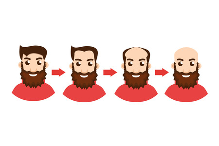 Stages Of Hair Loss with arrowのイラスト素材