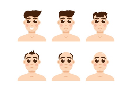 Hair stages loss. Types of baldness on male head vector.のイラスト素材