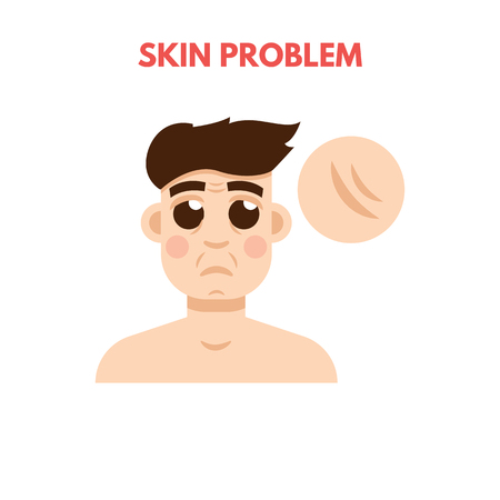 A man has skin problem and facial care.のイラスト素材