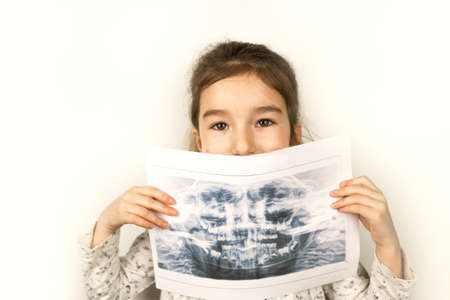 Girl holds her X-ray with a panorama of baby teeth and the second row of replaceable molars. Two rows of teeth, change to permanent teeth. Health and pediatric dentistry, orthodontics.の写真素材