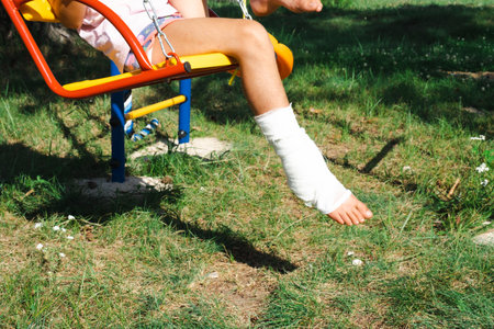 Children's legs are bandaged in plaster - barefoot on a swing. Traumatic equipment, child injury, bruise, sprain, fractureの写真素材