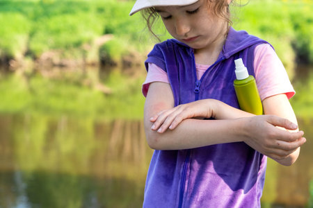 Girl sprays mosquito spray on the skin in nature that bite her hands and feet. Protection from insect bites, repellent safe for children. Outdoor recreation, against allergies. summer timeの写真素材