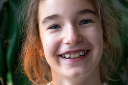 Portrait: Girl age 9 after using orthodontic plate, positive change in teeth and bite alignment,...