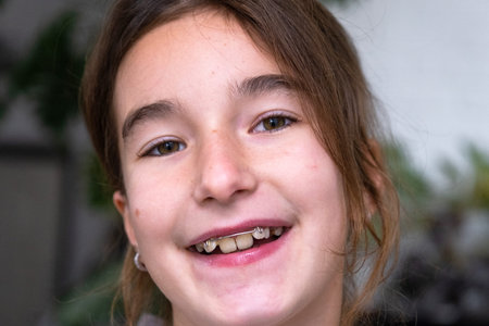 Child orthodontics: 9-year-old girl with dental appliance for bite and tooth alignment, healthy...