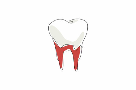 Single continuous line drawing tooth with the bottom covered in blood. Consequences of inconsistent...