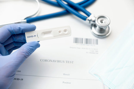 Covid-19 test. Cassette test for IgM / IgG antibodies. Coronavirus prevention