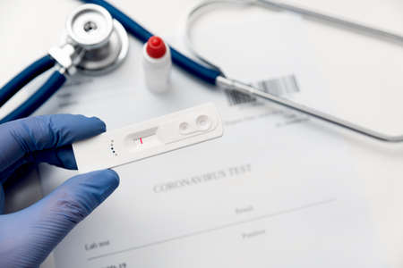 Cassette test for IgM / IgG antibodies. preventionの写真素材