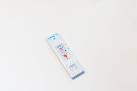 Laboratory test for the determination of coronavirus. Concept. On the table lies the consent to take...