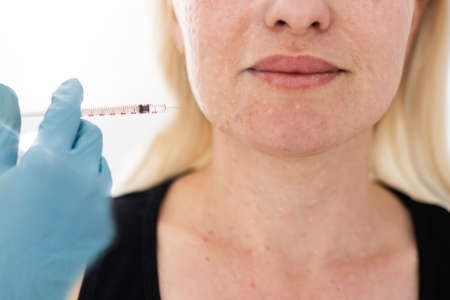 Bio-revitalization of the face and neck. The fight against the signs of aging and skin pigmentation.の写真素材