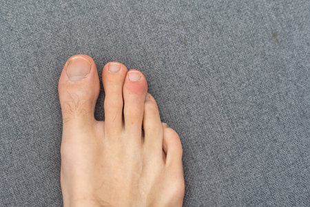 man toes with hair and dirty toenails.