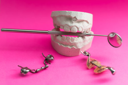 Dental casting gypsum model plaster cast stomatologic human jaws prothetic laboratory. dental plateの写真素材