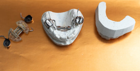 Dental casting gypsum model of human jaws. Crooked teeth and distal bite. plate for the toothの写真素材