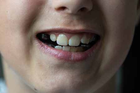 a little girl with a shifted dentition demonstrates her teethの写真素材